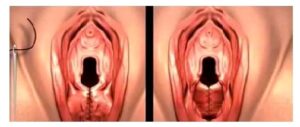 Kızlık zarı dikimi Kadınlar kulübü doktor takvimi doktorumsun en iyi kızlık zarı dikimi himenoplasti bekaret bakirelik testi kalıcı geçici lazerle muayenesi zedelenmesi kanaması onarımı tamiri dikişi kızlık zarı dikimi fiyatları fiyatı ücreti ücretleri Kızlık zarı dikimi himenoplasti bekaret kalıcı geçici lazerle muayenesi zedelenmesi kanaması onarımı tamiri dikişi kızlık zarı dikimi fiyat fiyatı fiyatları ücret ücreti ücretleri yaptıranlar yorumlar yaptıranların yorumları kadınlar kulübü 2019 2020 2021 2022 2023 ekşi before after öncesi sonrası resim fotoğraf video izle randevu veren yapan hastane hastaneler bayan kadın doktor doktorlar klinik klinikler kliniği nedir nasıl yapılır İstanbul’da İstanbul Avrupa yakası Anadolu yakası Türkiye, Adana, Adıyaman, Afyonkarahisar, Ağrı, Aksaray, Amasya, Ankara, Antalya, Ardahan, Artvin, Aydın, Balıkesir, Bartın, Batman, Bayburt, Bilecik, Bingöl, Bitlis, Bolu, Burdur, Bursa, Çanakkale, Çankırı, Çorum, Denizli, Diyarbakır, Düzce, Edirne, Elazığ, Erzincan, Erzurum, Eskişehir, Gaziantep, Giresun, Gümüşhane, Hakkâri, Hatay, Iğdır, Isparta, İstanbul, İzmir, Kahramanmaraş, Karabük, Karaman, Kars, Kastamonu, Kayseri, Kilis, Kırıkkale, Kırklareli, Kırşehir, Kocaeli, Konya, Kütahya, Malatya, Manisa, Mardin, Mersin, Muğla, Muş, Nevşehir, Niğde, Ordu, Osmaniye, Rize, Sakarya, Samsun, Şanlıurfa, Siirt, Sinop, Sivas, Şırnak, Tekirdağ, Tokat, Trabzon, Tunceli, Uşak, Van, Yalova, Yozgat, Zonguldak, Karaman, Fethiye, Bodrum, Adalar, Arnavutköy, Ataşehir, Avcılar, Bağcılar, Bahçelievler, Bakırköy, Başakşehir, Bayrampaşa, Beşiktaş, Beykoz, Beylikdüzü, Beyoğlu, Büyükçekmece, Çatalca, Çekmeköy, Esenler, Esenyurt, Eyüp, Fatih, Gaziosmanpaşa, Güngören, Kadıköy, Kağıthane, Kartal, Küçükçekmece, Maltepe, Pendik, Sancaktepe, Sarıyer, Silivri, Sultanbeyli, Sultangazi, Şile, Şişli, Tuzla, Ümraniye, Üsküdar, Zeytinburnu, Şişli, Nişantaşı, Mecidiyeköy, Acıbadem, Gebze, Çorlu, Tarsus, Viranşehir Kadınlar kulübü doktor takvimi doktorumsun en iyi kızlık zarı dikimi himenoplasti bekaret bakirelik testi kalıcı geçici lazerle muayenesi zedelenmesi kanaması onarımı tamiri dikişi kızlık zarı dikimi fiyatları fiyatı ücreti ücretleri Kızlık zarı dikimi himenoplasti bekaret kalıcı geçici lazerle muayenesi zedelenmesi kanaması onarımı tamiri dikişi kızlık zarı dikimi fiyat fiyatı fiyatları ücret ücreti ücretleri yaptıranlar yorumlar yaptıranların yorumları kadınlar kulübü 2019 2020 2021 2022 2023 ekşi before after öncesi sonrası resim fotoğraf video izle randevu veren yapan hastane hastaneler bayan kadın doktor doktorlar klinik klinikler kliniği nedir nasıl yapılır Türkiye, Adana, Adıyaman, Afyonkarahisar, Ağrı, Aksaray, Amasya, Ankara, Antalya, Ardahan, Artvin, Aydın, Balıkesir, Bartın, Batman, Bayburt, Bilecik, Bingöl, Bitlis, Bolu, Burdur, Bursa, Çanakkale, Çankırı, Çorum, Denizli, Diyarbakır, Düzce, Edirne, Elazığ, Erzincan, Erzurum, Eskişehir, Gaziantep, Giresun, Gümüşhane, Hakkâri, Hatay, Iğdır, Isparta, İstanbul, İzmir, Kahramanmaraş, Karabük, Karaman, Kars, Kastamonu, Kayseri, Kilis, Kırıkkale, Kırklareli, Kırşehir, Kocaeli, Konya, Kütahya, Malatya, Manisa, Mardin, Mersin, Muğla, Muş, Nevşehir, Niğde, Ordu, Osmaniye, Rize, Sakarya, Samsun, Şanlıurfa, Siirt, Sinop, Sivas, Şırnak, Tekirdağ, Tokat, Trabzon, Tunceli, Uşak, Van, Yalova, Yozgat, Zonguldak, Karaman, Fethiye, Bodrum, Adalar, Arnavutköy, Ataşehir, Avcılar, Bağcılar, Bahçelievler, Bakırköy, Başakşehir, Bayrampaşa, Beşiktaş, Beykoz, Beylikdüzü, Beyoğlu, Büyükçekmece, Çatalca, Çekmeköy, Esenler, Esenyurt, Eyüp, Fatih, Gaziosmanpaşa, Güngören, Kadıköy, Kağıthane, Kartal, Küçükçekmece, Maltepe, Pendik, Sancaktepe, Sarıyer, Silivri, Sultanbeyli, Sultangazi, Şile, Şişli, Tuzla, Ümraniye, Üsküdar, Zeytinburnu, Şişli, Nişantaşı, Mecidiyeköy, Acıbadem, Gebze, Çorlu, Tarsus, Viranşehir, İstanbul Avrupa yakası Anadolu yakası Kadınlar kulübü doktor takvimi doktorumsun en iyi Kızlık zarı dikimi himenoplasti bekaret bakirelik testi kalıcı geçici lazerle muayenesi zedelenmesi kanaması onarımı tamiri dikişi kızlık zarı dikimi fiyatları fiyatı ücreti ücretleri Kızlık zarı dikimi himenoplasti bekaret kalıcı geçici lazerle muayenesi zedelenmesi kanaması onarımı tamiri dikişi kızlık zarı dikimi fiyat fiyatı fiyatları ücret ücreti ücretleri yaptıranlar yorumlar yaptıranların yorumları kadınlar kulübü 2019 2020 2021 2022 2023 ekşi before after öncesi sonrası resim fotoğraf video izle randevu veren yapan hastane hastaneler bayan kadın doktor doktorlar klinik klinikler kliniği nedir nasıl yapılır.