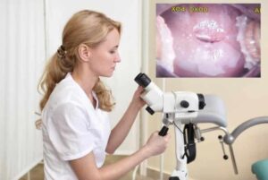 Siğil Kadınlar kulübü doktor takvimi doktorumsun en iyi lazerle rahim genital bikini bölgesi el ayak anal anogenital smear testi sonucu tipleri ilaçla ameliyatsız lazer ile dondurma yakma tedavi tedavisi vajina siğil siğili siğilleri kondilom HPV aşısı kolposkopi rahim ağzı yara yarası tedavisi kanama erezyon kanser kanseri patoloji biyopsi sonucu başlangıcı ameliyatı lazerle şekiller çeşitleri izi fiyat fiyatı fiyatları ücret ücreti ücretleri yaptıranlar yorumlar yaptıranların yorumları kadınlar kulübü 2019 2020 2021 2022 2023 ucuz en uygun hesaplı fiyat fiyatları fiyatı fiyatlı ücret ücreti ücretleri maliyet maliyeti rakam rakamları ekşi before after öncesi sonrası ağrı ağrısı kanama kanaması süre süresi iyileşme his kaybı resim fotoğraf video izle randevu veren yapan özel devlet hastanesi hastane hastaneler bayan kadın doktor doktorlar klinik klinikler kliniği neden ne kadar nedir nasıl yapılır İstanbul’da İstanbul Avrupa yakası Anadolu yakası Türkiye, Adana, Adıyaman, Afyonkarahisar, Ağrı, Aksaray, Amasya, Ankara, Antalya, Ardahan, Artvin, Aydın, Balıkesir, Bartın, Batman, Bayburt, Bilecik, Bingöl, Bitlis, Bolu, Burdur, Bursa, Çanakkale, Çankırı, Çorum, Denizli, Diyarbakır, Düzce, Edirne, Elazığ, Erzincan, Erzurum, Eskişehir, Gaziantep, Giresun, Gümüşhane, Hakkâri, Hatay, Iğdır, Isparta, İstanbul, İzmir, Kahramanmaraş, Karabük, Karaman, Kars, Kastamonu, Kayseri, Kilis, Kırıkkale, Kırklareli, Kırşehir, Kocaeli, Konya, Kütahya, Malatya, Manisa, Mardin, Mersin, Muğla, Muş, Nevşehir, Niğde, Ordu, Osmaniye, Rize, Sakarya, Samsun, Şanlıurfa, Siirt, Sinop, Sivas, Şırnak, Tekirdağ, Tokat, Trabzon, Tunceli, Uşak, Van, Yalova, Yozgat, Zonguldak, Karaman, Fethiye, Bodrum, Adalar, Arnavutköy, Ataşehir, Avcılar, Bağcılar, Bahçelievler, Bakırköy, Başakşehir, Bayrampaşa, Beşiktaş, Beykoz, Beylikdüzü, Beyoğlu, Büyükçekmece, Çatalca, Çekmeköy, Esenler, Esenyurt, Eyüp, Fatih, Gaziosmanpaşa, Güngören, Kadıköy, Kağıthane, Kartal, Küçükçekmece, Maltepe, Pendik, Sancaktepe, Sarıyer, Silivri, Sultanbeyli, Sultangazi, Şile, Şişli, Tuzla, Ümraniye, Üsküdar, Zeytinburnu, Şişli, Nişantaşı, Mecidiyeköy, Acıbadem, Gebze, Çorlu, Tarsus, Viranşehir Kadınlar kulübü doktor takvimi doktorumsun en iyi lazerle rahim genital bikini bölgesi el ayak anal anogenital smear testi sonucu tipleri ilaçla ameliyatsız lazer ile dondurma yakma tedavi tedavisi vajina siğil siğili siğilleri kondilom HPV aşısı kolposkopi rahim ağzı yara yarası tedavisi kanama erezyon kanser kanseri patoloji biyopsi sonucu başlangıcı ameliyatı lazerle şekiller çeşitleri izi fiyat fiyatı fiyatları ücret ücreti ücretleri yaptıranlar yorumlar yaptıranların yorumları kadınlar kulübü 2019 2020 2021 2022 2023 ucuz en uygun hesaplı fiyat fiyatları fiyatı fiyatlı ücret ücreti ücretleri maliyet maliyeti rakam rakamları ekşi before after öncesi sonrası ağrı ağrısı kanama kanaması süre süresi iyileşme his kaybı resim fotoğraf video izle randevu veren yapan özel devlet hastanesi hastane hastaneler bayan kadın doktor doktorlar klinik klinikler kliniği neden ne kadar nedir nasıl yapılır Türkiye, Adana, Adıyaman, Afyonkarahisar, Ağrı, Aksaray, Amasya, Ankara, Antalya, Ardahan, Artvin, Aydın, Balıkesir, Bartın, Batman, Bayburt, Bilecik, Bingöl, Bitlis, Bolu, Burdur, Bursa, Çanakkale, Çankırı, Çorum, Denizli, Diyarbakır, Düzce, Edirne, Elazığ, Erzincan, Erzurum, Eskişehir, Gaziantep, Giresun, Gümüşhane, Hakkâri, Hatay, Iğdır, Isparta, İstanbul, İzmir, Kahramanmaraş, Karabük, Karaman, Kars, Kastamonu, Kayseri, Kilis, Kırıkkale, Kırklareli, Kırşehir, Kocaeli, Konya, Kütahya, Malatya, Manisa, Mardin, Mersin, Muğla, Muş, Nevşehir, Niğde, Ordu, Osmaniye, Rize, Sakarya, Samsun, Şanlıurfa, Siirt, Sinop, Sivas, Şırnak, Tekirdağ, Tokat, Trabzon, Tunceli, Uşak, Van, Yalova, Yozgat, Zonguldak, Karaman, Fethiye, Bodrum, Adalar, Arnavutköy, Ataşehir, Avcılar, Bağcılar, Bahçelievler, Bakırköy, Başakşehir, Bayrampaşa, Beşiktaş, Beykoz, Beylikdüzü, Beyoğlu, Büyükçekmece, Çatalca, Çekmeköy, Esenler, Esenyurt, Eyüp, Fatih, Gaziosmanpaşa, Güngören, Kadıköy, Kağıthane, Kartal, Küçükçekmece, Maltepe, Pendik, Sancaktepe, Sarıyer, Silivri, Sultanbeyli, Sultangazi, Şile, Şişli, Tuzla, Ümraniye, Üsküdar, Zeytinburnu, Şişli, Nişantaşı, Mecidiyeköy, Acıbadem, Gebze, Çorlu, Tarsus, Viranşehir, İstanbul Avrupa yakası Anadolu yakası Kadınlar kulübü doktor takvimi doktorumsun en iyi lazerle rahim genital bikini bölgesi el ayak anal anogenital smear testi sonucu tipleri ilaçla ameliyatsız lazer ile dondurma yakma tedavi tedavisi vajina siğil siğili siğilleri kondilom HPV aşısı kolposkopi rahim ağzı yara yarası tedavisi kanama erezyon kanser kanseri patoloji biyopsi sonucu başlangıcı ameliyatı lazerle şekiller çeşitleri izi fiyat fiyatı fiyatları ücret ücreti ücretleri yaptıranlar yorumlar yaptıranların yorumları kadınlar kulübü 2019 2020 2021 2022 2023 2024 ucuz en uygun hesaplı fiyat fiyatları fiyatı fiyatlı ücret ücreti ücretleri maliyet maliyeti rakam rakamları ekşi before after öncesi sonrası ağrı ağrısı kanama kanaması süre süresi iyileşme his kaybı resim fotoğraf video izle randevu veren yapan özel devlet hastanesi hastane hastaneler bayan kadın doktor doktorlar klinik klinikler kliniği neden ne kadar nedir nasıl yapılır.