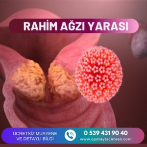 Op. Dr. Aytaç İMREN Rahim Ağzı yara tedavisi - Aytaç İMREN - Op. Dr. Aytaç İMREN