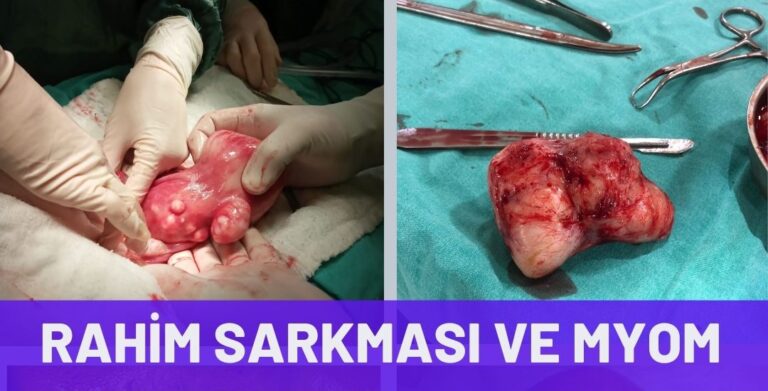 Rahim ameliyatı - Rahim ameliyatı fiyatları - Op. Dr. Aytaç İMREN Rahim ameliyatı Kadınlar kulübü doktor takvimi doktorumsun en iyi lazerle rahim genital vajina histerektomi laparoskopi laparoskopik açık kapalı yöntem rahim alma vajinal yolla histeroskopi kolposkopi rahim ağzı yara yarası tedavisi kanama erezyon kanser kanseri patoloji biyopsi sonucu başlangıcı kalınlaşma miyom myom uterus kapalı açık cerrahi ameliyatı lazerle şekiller çeşitleri izi fiyat fiyatı fiyatları ücret ücreti ücretleri yaptıranlar yorumlar yaptıranların yorumları kadınlar kulübü 2019 2020 2021 2022 2023 ucuz en uygun hesaplı fiyat fiyatları fiyatı fiyatlı ücret ücreti ücretleri maliyet maliyeti rakam rakamları ekşi before after öncesi sonrası ağrı ağrısı kanama kanaması süre süresi iyileşme his kaybı resim fotoğraf video izle randevu veren yapan özel devlet hastanesi hastane hastaneler bayan kadın doktor doktorlar klinik klinikler kliniği neden ne kadar nedir nasıl yapılır İstanbul’da İstanbul Avrupa yakası Anadolu yakası Türkiye, Adana, Adıyaman, Afyonkarahisar, Ağrı, Aksaray, Amasya, Ankara, Antalya, Ardahan, Artvin, Aydın, Balıkesir, Bartın, Batman, Bayburt, Bilecik, Bingöl, Bitlis, Bolu, Burdur, Bursa, Çanakkale, Çankırı, Çorum, Denizli, Diyarbakır, Düzce, Edirne, Elazığ, Erzincan, Erzurum, Eskişehir, Gaziantep, Giresun, Gümüşhane, Hakkâri, Hatay, Iğdır, Isparta, İstanbul, İzmir, Kahramanmaraş, Karabük, Karaman, Kars, Kastamonu, Kayseri, Kilis, Kırıkkale, Kırklareli, Kırşehir, Kocaeli, Konya, Kütahya, Malatya, Manisa, Mardin, Mersin, Muğla, Muş, Nevşehir, Niğde, Ordu, Osmaniye, Rize, Sakarya, Samsun, Şanlıurfa, Siirt, Sinop, Sivas, Şırnak, Tekirdağ, Tokat, Trabzon, Tunceli, Uşak, Van, Yalova, Yozgat, Zonguldak, Karaman, Fethiye, Bodrum, Adalar, Arnavutköy, Ataşehir, Avcılar, Bağcılar, Bahçelievler, Bakırköy, Başakşehir, Bayrampaşa, Beşiktaş, Beykoz, Beylikdüzü, Beyoğlu, Büyükçekmece, Çatalca, Çekmeköy, Esenler, Esenyurt, Eyüp, Fatih, Gaziosmanpaşa, Güngören, Kadıköy, Kağıthane, Kartal, Küçükçekmece, Maltepe, Pendik, Sancaktepe, Sarıyer, Silivri, Sultanbeyli, Sultangazi, Şile, Şişli, Tuzla, Ümraniye, Üsküdar, Zeytinburnu, Şişli, Nişantaşı, Mecidiyeköy, Acıbadem, Gebze, Çorlu, Tarsus, Viranşehir Kadınlar kulübü doktor takvimi doktorumsun en iyi lazerle rahim genital vajina histerektomi laparoskopi laparoskopik açık kapalı yöntem rahim alma vajinal yolla histeroskopi kolposkopi rahim ağzı yara yarası tedavisi kanama erezyon kanser kanseri patoloji biyopsi sonucu başlangıcı kalınlaşma miyom myom uterus kapalı açık cerrahi ameliyatı lazerle şekiller çeşitleri izi fiyat fiyatı fiyatları ücret ücreti ücretleri yaptıranlar yorumlar yaptıranların yorumları kadınlar kulübü 2019 2020 2021 2022 2023 ucuz en uygun hesaplı fiyat fiyatları fiyatı fiyatlı ücret ücreti ücretleri maliyet maliyeti rakam rakamları ekşi before after öncesi sonrası ağrı ağrısı kanama kanaması süre süresi iyileşme his kaybı resim fotoğraf video izle randevu veren yapan özel devlet hastanesi hastane hastaneler bayan kadın doktor doktorlar klinik klinikler kliniği neden ne kadar nedir nasıl yapılır Türkiye, Adana, Adıyaman, Afyonkarahisar, Ağrı, Aksaray, Amasya, Ankara, Antalya, Ardahan, Artvin, Aydın, Balıkesir, Bartın, Batman, Bayburt, Bilecik, Bingöl, Bitlis, Bolu, Burdur, Bursa, Çanakkale, Çankırı, Çorum, Denizli, Diyarbakır, Düzce, Edirne, Elazığ, Erzincan, Erzurum, Eskişehir, Gaziantep, Giresun, Gümüşhane, Hakkâri, Hatay, Iğdır, Isparta, İstanbul, İzmir, Kahramanmaraş, Karabük, Karaman, Kars, Kastamonu, Kayseri, Kilis, Kırıkkale, Kırklareli, Kırşehir, Kocaeli, Konya, Kütahya, Malatya, Manisa, Mardin, Mersin, Muğla, Muş, Nevşehir, Niğde, Ordu, Osmaniye, Rize, Sakarya, Samsun, Şanlıurfa, Siirt, Sinop, Sivas, Şırnak, Tekirdağ, Tokat, Trabzon, Tunceli, Uşak, Van, Yalova, Yozgat, Zonguldak, Karaman, Fethiye, Bodrum, Adalar, Arnavutköy, Ataşehir, Avcılar, Bağcılar, Bahçelievler, Bakırköy, Başakşehir, Bayrampaşa, Beşiktaş, Beykoz, Beylikdüzü, Beyoğlu, Büyükçekmece, Çatalca, Çekmeköy, Esenler, Esenyurt, Eyüp, Fatih, Gaziosmanpaşa, Güngören, Kadıköy, Kağıthane, Kartal, Küçükçekmece, Maltepe, Pendik, Sancaktepe, Sarıyer, Silivri, Sultanbeyli, Sultangazi, Şile, Şişli, Tuzla, Ümraniye, Üsküdar, Zeytinburnu, Şişli, Nişantaşı, Mecidiyeköy, Acıbadem, Gebze, Çorlu, Tarsus, Viranşehir, İstanbul Avrupa yakası Anadolu yakası Kadınlar kulübü doktor takvimi doktorumsun en iyi lazerle rahim genital vajina histerektomi laparoskopi laparoskopik açık kapalı yöntem rahim alma vajinal yolla histeroskopi kolposkopi rahim ağzı yara yarası tedavisi kanama erezyon kanser kanseri patoloji biyopsi sonucu başlangıcı kalınlaşma miyom myom uterus kapalı açık cerrahi ameliyatı lazerle şekiller çeşitleri izi fiyat fiyatı fiyatları ücret ücreti ücretleri yaptıranlar yorumlar yaptıranların yorumları kadınlar kulübü 2019 2020 2021 2022 2023 ucuz en uygun hesaplı fiyat fiyatları fiyatı fiyatlı ücret ücreti ücretleri maliyet maliyeti rakam rakamları ekşi before after öncesi sonrası ağrı ağrısı kanama kanaması süre süresi iyileşme his kaybı resim fotoğraf video izle randevu veren yapan özel devlet hastanesi hastane hastaneler bayan kadın doktor doktorlar klinik klinikler kliniği neden ne kadar nedir nasıl yapılır.