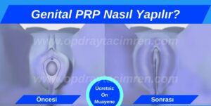 Genital estetik Kadınlar kulübü doktor takvimi doktorumsun en iyi lazerle rahim genital klitoris vajina dış iç dudak labium labioplasti labiaplasty labioplasty vajinoplasti daraltma beyazlatma sıkılaştırma PRP ozon orgasm orgazm G noktası G spot G shot O noktası O spot O shot dolgusu aşısı gençleştirme rejuveneation sarkması sarkıklığı küçültme küçültülmesi dolgusu dolgunlaştırma estetik estetiği ameliyatı lazerle tedavisi şekiller çeşitleri izi fiyat fiyatı fiyatları ücret ücreti ücretleri yaptıranlar yorumlar yaptıranların yorumları kadınlar kulübü ekşi before after öncesi sonrası resim fotoğraf video izle randevu veren yapan bay erkek bayan kadın doktor doktorlar hastane hastaneler hastanesi klinik klinikler kliniği 2019 2020 2021 2022 2023 ucuz en uygun hesaplı fiyat fiyatları fiyatı fiyatlı ücret ücreti ücretleri maliyet maliyeti rakam rakamları neden ne kadar nedir nasıl yapılır İstanbul’da İstanbul Avrupa yakası Anadolu yakası Türkiye, Adana, Adıyaman, Afyonkarahisar, Ağrı, Aksaray, Amasya, Ankara, Antalya, Ardahan, Artvin, Aydın, Balıkesir, Bartın, Batman, Bayburt, Bilecik, Bingöl, Bitlis, Bolu, Burdur, Bursa, Çanakkale, Çankırı, Çorum, Denizli, Diyarbakır, Düzce, Edirne, Elazığ, Erzincan, Erzurum, Eskişehir, Gaziantep, Giresun, Gümüşhane, Hakkâri, Hatay, Iğdır, Isparta, İstanbul, İzmir, Kahramanmaraş, Karabük, Karaman, Kars, Kastamonu, Kayseri, Kilis, Kırıkkale, Kırklareli, Kırşehir, Kocaeli, Konya, Kütahya, Malatya, Manisa, Mardin, Mersin, Muğla, Muş, Nevşehir, Niğde, Ordu, Osmaniye, Rize, Sakarya, Samsun, Şanlıurfa, Siirt, Sinop, Sivas, Şırnak, Tekirdağ, Tokat, Trabzon, Tunceli, Uşak, Van, Yalova, Yozgat, Zonguldak, Karaman, Fethiye, Bodrum, Adalar, Arnavutköy, Ataşehir, Avcılar, Bağcılar, Bahçelievler, Bakırköy, Başakşehir, Bayrampaşa, Beşiktaş, Beykoz, Beylikdüzü, Beyoğlu, Büyükçekmece, Çatalca, Çekmeköy, Esenler, Esenyurt, Eyüp, Fatih, Gaziosmanpaşa, Güngören, Kadıköy, Kağıthane, Kartal, Küçükçekmece, Maltepe, Pendik, Sancaktepe, Sarıyer, Silivri, Sultanbeyli, Sultangazi, Şile, Şişli, Tuzla, Ümraniye, Üsküdar, Zeytinburnu, Şişli, Nişantaşı, Mecidiyeköy, Acıbadem, Gebze, Çorlu, Tarsus, Viranşehir Kadınlar kulübü doktor takvimi doktorumsun en iyi lazerle rahim genital vajina klitoris dış iç dudak labium labioplasti labiaplasty labioplasty vajinoplasti daraltma beyazlatma sıkılaştırma PRP ozon orgasm orgazm G noktası G spot G shot O noktası O spot O shot dolgusu aşısı gençleştirme rejuveneation sarkması sarkıklığı küçültme küçültülmesi dolgusu dolgunlaştırma estetik estetiği ameliyatı lazerle tedavisi şekiller çeşitleri izi fiyat fiyatı fiyatları ücret ücreti ücretleri yaptıranlar yorumlar yaptıranların yorumları kadınlar kulübü ekşi before after öncesi sonrası resim fotoğraf video izle randevu veren yapan bay erkek bayan kadın doktor doktorlar hastane hastaneler hastanesi klinik klinikler kliniği 2019 2020 2021 2022 2023 ucuz en uygun hesaplı fiyat fiyatları fiyatı fiyatlı ücret ücreti ücretleri maliyet maliyeti rakam rakamları neden ne kadar nedir nasıl yapılır Türkiye, Adana, Adıyaman, Afyonkarahisar, Ağrı, Aksaray, Amasya, Ankara, Antalya, Ardahan, Artvin, Aydın, Balıkesir, Bartın, Batman, Bayburt, Bilecik, Bingöl, Bitlis, Bolu, Burdur, Bursa, Çanakkale, Çankırı, Çorum, Denizli, Diyarbakır, Düzce, Edirne, Elazığ, Erzincan, Erzurum, Eskişehir, Gaziantep, Giresun, Gümüşhane, Hakkâri, Hatay, Iğdır, Isparta, İstanbul, İzmir, Kahramanmaraş, Karabük, Karaman, Kars, Kastamonu, Kayseri, Kilis, Kırıkkale, Kırklareli, Kırşehir, Kocaeli, Konya, Kütahya, Malatya, Manisa, Mardin, Mersin, Muğla, Muş, Nevşehir, Niğde, Ordu, Osmaniye, Rize, Sakarya, Samsun, Şanlıurfa, Siirt, Sinop, Sivas, Şırnak, Tekirdağ, Tokat, Trabzon, Tunceli, Uşak, Van, Yalova, Yozgat, Zonguldak, Karaman, Fethiye, Bodrum, Adalar, Arnavutköy, Ataşehir, Avcılar, Bağcılar, Bahçelievler, Bakırköy, Başakşehir, Bayrampaşa, Beşiktaş, Beykoz, Beylikdüzü, Beyoğlu, Büyükçekmece, Çatalca, Çekmeköy, Esenler, Esenyurt, Eyüp, Fatih, Gaziosmanpaşa, Güngören, Kadıköy, Kağıthane, Kartal, Küçükçekmece, Maltepe, Pendik, Sancaktepe, Sarıyer, Silivri, Sultanbeyli, Sultangazi, Şile, Şişli, Tuzla, Ümraniye, Üsküdar, Zeytinburnu, Şişli, Nişantaşı, Mecidiyeköy, Acıbadem, Gebze, Çorlu, Tarsus, Viranşehir, İstanbul Avrupa yakası Anadolu yakası Kadınlar kulübü doktor takvimi doktorumsun en iyi lazerle rahim genital vajina klitoris dış iç dudak labium labioplasti labiaplasty labioplasty vajinoplasti daraltma beyazlatma sıkılaştırma PRP ozon orgasm orgazm G noktası G spot G shot O noktası O spot O shot dolgusu aşısı gençleştirme rejuveneation sarkması sarkıklığı küçültme küçültülmesi dolgusu dolgunlaştırma estetik estetiği ameliyatı lazerle tedavisi şekiller çeşitleri izi fiyat fiyatı fiyatları ücret ücreti ücretleri yaptıranlar yorumlar yaptıranların yorumları kadınlar kulübü ekşi before after öncesi sonrası resim fotoğraf video izle randevu veren yapan bay erkek bayan kadın doktor doktorlar hastane hastaneler hastanesi klinik klinikler kliniği 2019 2020 2021 2022 2023 ucuz en uygun hesaplı fiyat fiyatları fiyatı fiyatlı ücret ücreti ücretleri maliyet maliyeti rakam rakamları neden ne kadar nedir nasıl yapılır.