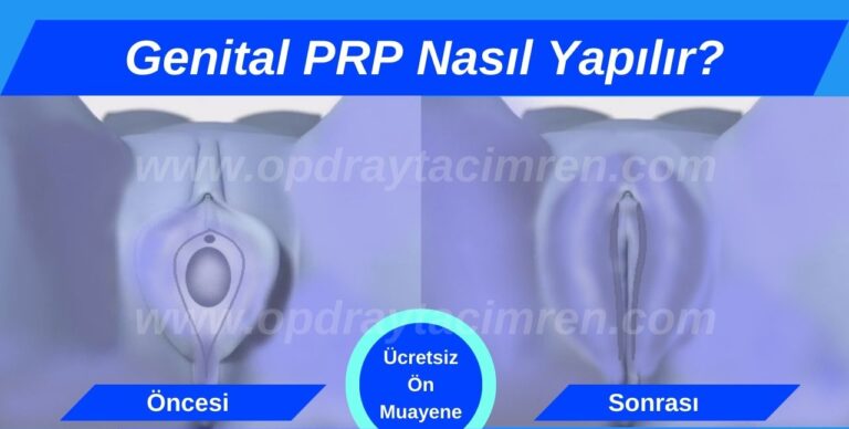 Genital PRP - Genital PRP - Op. Dr. Aytaç İMREN Genital estetik Kadınlar kulübü doktor takvimi doktorumsun en iyi lazerle rahim genital klitoris vajina dış iç dudak labium labioplasti labiaplasty labioplasty vajinoplasti daraltma beyazlatma sıkılaştırma PRP ozon orgasm orgazm G noktası G spot G shot O noktası O spot O shot dolgusu aşısı gençleştirme rejuveneation sarkması sarkıklığı küçültme küçültülmesi dolgusu dolgunlaştırma estetik estetiği ameliyatı lazerle tedavisi şekiller çeşitleri izi fiyat fiyatı fiyatları ücret ücreti ücretleri yaptıranlar yorumlar yaptıranların yorumları kadınlar kulübü ekşi before after öncesi sonrası resim fotoğraf video izle randevu veren yapan bay erkek bayan kadın doktor doktorlar hastane hastaneler hastanesi klinik klinikler kliniği 2019 2020 2021 2022 2023 ucuz en uygun hesaplı fiyat fiyatları fiyatı fiyatlı ücret ücreti ücretleri maliyet maliyeti rakam rakamları neden ne kadar nedir nasıl yapılır İstanbul’da İstanbul Avrupa yakası Anadolu yakası Türkiye, Adana, Adıyaman, Afyonkarahisar, Ağrı, Aksaray, Amasya, Ankara, Antalya, Ardahan, Artvin, Aydın, Balıkesir, Bartın, Batman, Bayburt, Bilecik, Bingöl, Bitlis, Bolu, Burdur, Bursa, Çanakkale, Çankırı, Çorum, Denizli, Diyarbakır, Düzce, Edirne, Elazığ, Erzincan, Erzurum, Eskişehir, Gaziantep, Giresun, Gümüşhane, Hakkâri, Hatay, Iğdır, Isparta, İstanbul, İzmir, Kahramanmaraş, Karabük, Karaman, Kars, Kastamonu, Kayseri, Kilis, Kırıkkale, Kırklareli, Kırşehir, Kocaeli, Konya, Kütahya, Malatya, Manisa, Mardin, Mersin, Muğla, Muş, Nevşehir, Niğde, Ordu, Osmaniye, Rize, Sakarya, Samsun, Şanlıurfa, Siirt, Sinop, Sivas, Şırnak, Tekirdağ, Tokat, Trabzon, Tunceli, Uşak, Van, Yalova, Yozgat, Zonguldak, Karaman, Fethiye, Bodrum, Adalar, Arnavutköy, Ataşehir, Avcılar, Bağcılar, Bahçelievler, Bakırköy, Başakşehir, Bayrampaşa, Beşiktaş, Beykoz, Beylikdüzü, Beyoğlu, Büyükçekmece, Çatalca, Çekmeköy, Esenler, Esenyurt, Eyüp, Fatih, Gaziosmanpaşa, Güngören, Kadıköy, Kağıthane, Kartal, Küçükçekmece, Maltepe, Pendik, Sancaktepe, Sarıyer, Silivri, Sultanbeyli, Sultangazi, Şile, Şişli, Tuzla, Ümraniye, Üsküdar, Zeytinburnu, Şişli, Nişantaşı, Mecidiyeköy, Acıbadem, Gebze, Çorlu, Tarsus, Viranşehir Kadınlar kulübü doktor takvimi doktorumsun en iyi lazerle rahim genital vajina klitoris dış iç dudak labium labioplasti labiaplasty labioplasty vajinoplasti daraltma beyazlatma sıkılaştırma PRP ozon orgasm orgazm G noktası G spot G shot O noktası O spot O shot dolgusu aşısı gençleştirme rejuveneation sarkması sarkıklığı küçültme küçültülmesi dolgusu dolgunlaştırma estetik estetiği ameliyatı lazerle tedavisi şekiller çeşitleri izi fiyat fiyatı fiyatları ücret ücreti ücretleri yaptıranlar yorumlar yaptıranların yorumları kadınlar kulübü ekşi before after öncesi sonrası resim fotoğraf video izle randevu veren yapan bay erkek bayan kadın doktor doktorlar hastane hastaneler hastanesi klinik klinikler kliniği 2019 2020 2021 2022 2023 ucuz en uygun hesaplı fiyat fiyatları fiyatı fiyatlı ücret ücreti ücretleri maliyet maliyeti rakam rakamları neden ne kadar nedir nasıl yapılır Türkiye, Adana, Adıyaman, Afyonkarahisar, Ağrı, Aksaray, Amasya, Ankara, Antalya, Ardahan, Artvin, Aydın, Balıkesir, Bartın, Batman, Bayburt, Bilecik, Bingöl, Bitlis, Bolu, Burdur, Bursa, Çanakkale, Çankırı, Çorum, Denizli, Diyarbakır, Düzce, Edirne, Elazığ, Erzincan, Erzurum, Eskişehir, Gaziantep, Giresun, Gümüşhane, Hakkâri, Hatay, Iğdır, Isparta, İstanbul, İzmir, Kahramanmaraş, Karabük, Karaman, Kars, Kastamonu, Kayseri, Kilis, Kırıkkale, Kırklareli, Kırşehir, Kocaeli, Konya, Kütahya, Malatya, Manisa, Mardin, Mersin, Muğla, Muş, Nevşehir, Niğde, Ordu, Osmaniye, Rize, Sakarya, Samsun, Şanlıurfa, Siirt, Sinop, Sivas, Şırnak, Tekirdağ, Tokat, Trabzon, Tunceli, Uşak, Van, Yalova, Yozgat, Zonguldak, Karaman, Fethiye, Bodrum, Adalar, Arnavutköy, Ataşehir, Avcılar, Bağcılar, Bahçelievler, Bakırköy, Başakşehir, Bayrampaşa, Beşiktaş, Beykoz, Beylikdüzü, Beyoğlu, Büyükçekmece, Çatalca, Çekmeköy, Esenler, Esenyurt, Eyüp, Fatih, Gaziosmanpaşa, Güngören, Kadıköy, Kağıthane, Kartal, Küçükçekmece, Maltepe, Pendik, Sancaktepe, Sarıyer, Silivri, Sultanbeyli, Sultangazi, Şile, Şişli, Tuzla, Ümraniye, Üsküdar, Zeytinburnu, Şişli, Nişantaşı, Mecidiyeköy, Acıbadem, Gebze, Çorlu, Tarsus, Viranşehir, İstanbul Avrupa yakası Anadolu yakası Kadınlar kulübü doktor takvimi doktorumsun en iyi lazerle rahim genital vajina klitoris dış iç dudak labium labioplasti labiaplasty labioplasty vajinoplasti daraltma beyazlatma sıkılaştırma PRP ozon orgasm orgazm G noktası G spot G shot O noktası O spot O shot dolgusu aşısı gençleştirme rejuveneation sarkması sarkıklığı küçültme küçültülmesi dolgusu dolgunlaştırma estetik estetiği ameliyatı lazerle tedavisi şekiller çeşitleri izi fiyat fiyatı fiyatları ücret ücreti ücretleri yaptıranlar yorumlar yaptıranların yorumları kadınlar kulübü ekşi before after öncesi sonrası resim fotoğraf video izle randevu veren yapan bay erkek bayan kadın doktor doktorlar hastane hastaneler hastanesi klinik klinikler kliniği 2019 2020 2021 2022 2023 ucuz en uygun hesaplı fiyat fiyatları fiyatı fiyatlı ücret ücreti ücretleri maliyet maliyeti rakam rakamları neden ne kadar nedir nasıl yapılır.