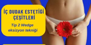 İç dudak estetiği labioplasti Kadınlar kulübü doktor takvimi doktorumsun en iyi lazerle rahim genital vajina dış iç dudak labium labioplasti labiaplasty labioplasty sarkması sarkıklığı küçültme küçültülmesi dolgusu dolgunlaştırma estetik estetiği ameliyatı lazerle şekiller çeşitleri kanama ağrı süre kanaması ağrısı süresi izi ucuz en uygun hesaplı fiyatlı fiyat fiyatı fiyatları ücret ücreti ücretleri yaptıranlar yorumlar yaptıranların yorumları kadınlar kulübü 2019 2020 2021 2022 2023 ekşi before after öncesi sonrası resim fotoğraf video izle randevu veren yapan hastane hastaneler bayan kadın doktor doktorlar klinik klinikler kliniği neden ne kadar nedir nasıl yapılır Türkiye İstanbul’da İstanbul Avrupa yakası Anadolu yakası Türkiye, Adana, Adıyaman, Afyonkarahisar, Ağrı, Aksaray, Amasya, Ankara, Antalya, Ardahan, Artvin, Aydın, Balıkesir, Bartın, Batman, Bayburt, Bilecik, Bingöl, Bitlis, Bolu, Burdur, Bursa, Çanakkale, Çankırı, Çorum, Denizli, Diyarbakır, Düzce, Edirne, Elazığ, Erzincan, Erzurum, Eskişehir, Gaziantep, Giresun, Gümüşhane, Hakkâri, Hatay, Iğdır, Isparta, İstanbul, İzmir, Kahramanmaraş, Karabük, Karaman, Kars, Kastamonu, Kayseri, Kilis, Kırıkkale, Kırklareli, Kırşehir, Kocaeli, Konya, Kütahya, Malatya, Manisa, Mardin, Mersin, Muğla, Muş, Nevşehir, Niğde, Ordu, Osmaniye, Rize, Sakarya, Samsun, Şanlıurfa, Siirt, Sinop, Sivas, Şırnak, Tekirdağ, Tokat, Trabzon, Tunceli, Uşak, Van, Yalova, Yozgat, Zonguldak, Karaman, Fethiye, Bodrum, Adalar, Arnavutköy, Ataşehir, Avcılar, Bağcılar, Bahçelievler, Bakırköy, Başakşehir, Bayrampaşa, Beşiktaş, Beykoz, Beylikdüzü, Beyoğlu, Büyükçekmece, Çatalca, Çekmeköy, Esenler, Esenyurt, Eyüp, Fatih, Gaziosmanpaşa, Güngören, Kadıköy, Kağıthane, Kartal, Küçükçekmece, Maltepe, Pendik, Sancaktepe, Sarıyer, Silivri, Sultanbeyli, Sultangazi, Şile, Şişli, Tuzla, Ümraniye, Üsküdar, Zeytinburnu, Şişli, Nişantaşı, Mecidiyeköy, Acıbadem, Gebze, Çorlu, Tarsus, Viranşehir Kadınlar kulübü doktor takvimi doktorumsun en iyi lazerle rahim genital vajina dış iç dudak labium labioplasti labiaplasty labioplasty sarkması sarkıklığı küçültme küçültülmesi dolgusu dolgunlaştırma estetik estetiği ameliyatı lazerle şekiller çeşitleri kanama ağrı süre kanaması ağrısı süresi izi ucuz en uygun hesaplı fiyatlı fiyat fiyatı fiyatları ücret ücreti ücretleri yaptıranlar yorumlar yaptıranların yorumları kadınlar kulübü 2019 2020 2021 2022 2023 ekşi before after öncesi sonrası resim fotoğraf video izle randevu veren yapan hastane hastaneler bayan kadın doktor doktorlar klinik klinikler kliniği neden ne kadar nedir nasıl yapılır Türkiye İstanbul’da, Adana, Adıyaman, Afyonkarahisar, Ağrı, Aksaray, Amasya, Ankara, Antalya, Ardahan, Artvin, Aydın, Balıkesir, Bartın, Batman, Bayburt, Bilecik, Bingöl, Bitlis, Bolu, Burdur, Bursa, Çanakkale, Çankırı, Çorum, Denizli, Diyarbakır, Düzce, Edirne, Elazığ, Erzincan, Erzurum, Eskişehir, Gaziantep, Giresun, Gümüşhane, Hakkâri, Hatay, Iğdır, Isparta, İstanbul, İzmir, Kahramanmaraş, Karabük, Karaman, Kars, Kastamonu, Kayseri, Kilis, Kırıkkale, Kırklareli, Kırşehir, Kocaeli, Konya, Kütahya, Malatya, Manisa, Mardin, Mersin, Muğla, Muş, Nevşehir, Niğde, Ordu, Osmaniye, Rize, Sakarya, Samsun, Şanlıurfa, Siirt, Sinop, Sivas, Şırnak, Tekirdağ, Tokat, Trabzon, Tunceli, Uşak, Van, Yalova, Yozgat, Zonguldak, Karaman, Fethiye, Bodrum, Adalar, Arnavutköy, Ataşehir, Avcılar, Bağcılar, Bahçelievler, Bakırköy, Başakşehir, Bayrampaşa, Beşiktaş, Beykoz, Beylikdüzü, Beyoğlu, Büyükçekmece, Çatalca, Çekmeköy, Esenler, Esenyurt, Eyüp, Fatih, Gaziosmanpaşa, Güngören, Kadıköy, Kağıthane, Kartal, Küçükçekmece, Maltepe, Pendik, Sancaktepe, Sarıyer, Silivri, Sultanbeyli, Sultangazi, Şile, Şişli, Tuzla, Ümraniye, Üsküdar, Zeytinburnu, Şişli, Nişantaşı, Mecidiyeköy, Acıbadem, Gebze, Çorlu, Tarsus, Viranşehir, İstanbul Avrupa yakası Anadolu yakası Kadınlar kulübü doktor takvimi doktorumsun en iyi lazerle rahim genital vajina dış iç dudak labium labioplasti labiaplasty labioplasty sarkması sarkıklığı küçültme küçültülmesi dolgusu dolgunlaştırma estetik estetiği ameliyatı lazerle şekiller çeşitleri kanama ağrı süre kanaması ağrısı süresi izi ucuz en uygun hesaplı fiyatlı fiyat fiyatı fiyatları ücret ücreti ücretleri yaptıranlar yorumlar yaptıranların yorumları kadınlar kulübü 2019 2020 2021 2022 2023 ekşi before after öncesi sonrası resim fotoğraf video izle randevu veren yapan hastane hastaneler bayan kadın doktor doktorlar klinik klinikler kliniği neden ne kadar nedir nasıl yapılır.