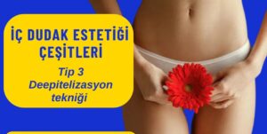 İç dudak estetiği labioplasti Kadınlar kulübü doktor takvimi doktorumsun en iyi lazerle rahim genital vajina dış iç dudak labium labioplasti labiaplasty labioplasty sarkması sarkıklığı küçültme küçültülmesi dolgusu dolgunlaştırma estetik estetiği ameliyatı lazerle şekiller çeşitleri kanama ağrı süre kanaması ağrısı süresi izi ucuz en uygun hesaplı fiyatlı fiyat fiyatı fiyatları ücret ücreti ücretleri yaptıranlar yorumlar yaptıranların yorumları kadınlar kulübü 2019 2020 2021 2022 2023 ekşi before after öncesi sonrası resim fotoğraf video izle randevu veren yapan hastane hastaneler bayan kadın doktor doktorlar klinik klinikler kliniği neden ne kadar nedir nasıl yapılır Türkiye İstanbul’da İstanbul Avrupa yakası Anadolu yakası Türkiye, Adana, Adıyaman, Afyonkarahisar, Ağrı, Aksaray, Amasya, Ankara, Antalya, Ardahan, Artvin, Aydın, Balıkesir, Bartın, Batman, Bayburt, Bilecik, Bingöl, Bitlis, Bolu, Burdur, Bursa, Çanakkale, Çankırı, Çorum, Denizli, Diyarbakır, Düzce, Edirne, Elazığ, Erzincan, Erzurum, Eskişehir, Gaziantep, Giresun, Gümüşhane, Hakkâri, Hatay, Iğdır, Isparta, İstanbul, İzmir, Kahramanmaraş, Karabük, Karaman, Kars, Kastamonu, Kayseri, Kilis, Kırıkkale, Kırklareli, Kırşehir, Kocaeli, Konya, Kütahya, Malatya, Manisa, Mardin, Mersin, Muğla, Muş, Nevşehir, Niğde, Ordu, Osmaniye, Rize, Sakarya, Samsun, Şanlıurfa, Siirt, Sinop, Sivas, Şırnak, Tekirdağ, Tokat, Trabzon, Tunceli, Uşak, Van, Yalova, Yozgat, Zonguldak, Karaman, Fethiye, Bodrum, Adalar, Arnavutköy, Ataşehir, Avcılar, Bağcılar, Bahçelievler, Bakırköy, Başakşehir, Bayrampaşa, Beşiktaş, Beykoz, Beylikdüzü, Beyoğlu, Büyükçekmece, Çatalca, Çekmeköy, Esenler, Esenyurt, Eyüp, Fatih, Gaziosmanpaşa, Güngören, Kadıköy, Kağıthane, Kartal, Küçükçekmece, Maltepe, Pendik, Sancaktepe, Sarıyer, Silivri, Sultanbeyli, Sultangazi, Şile, Şişli, Tuzla, Ümraniye, Üsküdar, Zeytinburnu, Şişli, Nişantaşı, Mecidiyeköy, Acıbadem, Gebze, Çorlu, Tarsus, Viranşehir Kadınlar kulübü doktor takvimi doktorumsun en iyi lazerle rahim genital vajina dış iç dudak labium labioplasti labiaplasty labioplasty sarkması sarkıklığı küçültme küçültülmesi dolgusu dolgunlaştırma estetik estetiği ameliyatı lazerle şekiller çeşitleri kanama ağrı süre kanaması ağrısı süresi izi ucuz en uygun hesaplı fiyatlı fiyat fiyatı fiyatları ücret ücreti ücretleri yaptıranlar yorumlar yaptıranların yorumları kadınlar kulübü 2019 2020 2021 2022 2023 ekşi before after öncesi sonrası resim fotoğraf video izle randevu veren yapan hastane hastaneler bayan kadın doktor doktorlar klinik klinikler kliniği neden ne kadar nedir nasıl yapılır Türkiye İstanbul’da, Adana, Adıyaman, Afyonkarahisar, Ağrı, Aksaray, Amasya, Ankara, Antalya, Ardahan, Artvin, Aydın, Balıkesir, Bartın, Batman, Bayburt, Bilecik, Bingöl, Bitlis, Bolu, Burdur, Bursa, Çanakkale, Çankırı, Çorum, Denizli, Diyarbakır, Düzce, Edirne, Elazığ, Erzincan, Erzurum, Eskişehir, Gaziantep, Giresun, Gümüşhane, Hakkâri, Hatay, Iğdır, Isparta, İstanbul, İzmir, Kahramanmaraş, Karabük, Karaman, Kars, Kastamonu, Kayseri, Kilis, Kırıkkale, Kırklareli, Kırşehir, Kocaeli, Konya, Kütahya, Malatya, Manisa, Mardin, Mersin, Muğla, Muş, Nevşehir, Niğde, Ordu, Osmaniye, Rize, Sakarya, Samsun, Şanlıurfa, Siirt, Sinop, Sivas, Şırnak, Tekirdağ, Tokat, Trabzon, Tunceli, Uşak, Van, Yalova, Yozgat, Zonguldak, Karaman, Fethiye, Bodrum, Adalar, Arnavutköy, Ataşehir, Avcılar, Bağcılar, Bahçelievler, Bakırköy, Başakşehir, Bayrampaşa, Beşiktaş, Beykoz, Beylikdüzü, Beyoğlu, Büyükçekmece, Çatalca, Çekmeköy, Esenler, Esenyurt, Eyüp, Fatih, Gaziosmanpaşa, Güngören, Kadıköy, Kağıthane, Kartal, Küçükçekmece, Maltepe, Pendik, Sancaktepe, Sarıyer, Silivri, Sultanbeyli, Sultangazi, Şile, Şişli, Tuzla, Ümraniye, Üsküdar, Zeytinburnu, Şişli, Nişantaşı, Mecidiyeköy, Acıbadem, Gebze, Çorlu, Tarsus, Viranşehir, İstanbul Avrupa yakası Anadolu yakası Kadınlar kulübü doktor takvimi doktorumsun en iyi lazerle rahim genital vajina dış iç dudak labium labioplasti labiaplasty labioplasty sarkması sarkıklığı küçültme küçültülmesi dolgusu dolgunlaştırma estetik estetiği ameliyatı lazerle şekiller çeşitleri kanama ağrı süre kanaması ağrısı süresi izi ucuz en uygun hesaplı fiyatlı fiyat fiyatı fiyatları ücret ücreti ücretleri yaptıranlar yorumlar yaptıranların yorumları kadınlar kulübü 2019 2020 2021 2022 2023 ekşi before after öncesi sonrası resim fotoğraf video izle randevu veren yapan hastane hastaneler bayan kadın doktor doktorlar klinik klinikler kliniği neden ne kadar nedir nasıl yapılır.