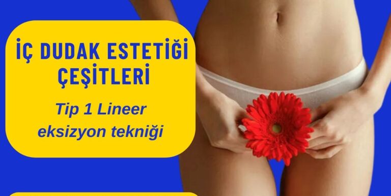 İç dudak estetiği labioplasti Kadınlar kulübü doktor takvimi doktorumsun en iyi lazerle rahim genital vajina dış iç dudak labium labioplasti labiaplasty labioplasty sarkması sarkıklığı küçültme küçültülmesi dolgusu dolgunlaştırma estetik estetiği ameliyatı lazerle şekiller çeşitleri kanama ağrı süre kanaması ağrısı süresi izi ucuz en uygun hesaplı fiyatlı fiyat fiyatı fiyatları ücret ücreti ücretleri yaptıranlar yorumlar yaptıranların yorumları kadınlar kulübü 2019 2020 2021 2022 2023 ekşi before after öncesi sonrası resim fotoğraf video izle randevu veren yapan hastane hastaneler bayan kadın doktor doktorlar klinik klinikler kliniği neden ne kadar nedir nasıl yapılır Türkiye İstanbul’da İstanbul Avrupa yakası Anadolu yakası Türkiye, Adana, Adıyaman, Afyonkarahisar, Ağrı, Aksaray, Amasya, Ankara, Antalya, Ardahan, Artvin, Aydın, Balıkesir, Bartın, Batman, Bayburt, Bilecik, Bingöl, Bitlis, Bolu, Burdur, Bursa, Çanakkale, Çankırı, Çorum, Denizli, Diyarbakır, Düzce, Edirne, Elazığ, Erzincan, Erzurum, Eskişehir, Gaziantep, Giresun, Gümüşhane, Hakkâri, Hatay, Iğdır, Isparta, İstanbul, İzmir, Kahramanmaraş, Karabük, Karaman, Kars, Kastamonu, Kayseri, Kilis, Kırıkkale, Kırklareli, Kırşehir, Kocaeli, Konya, Kütahya, Malatya, Manisa, Mardin, Mersin, Muğla, Muş, Nevşehir, Niğde, Ordu, Osmaniye, Rize, Sakarya, Samsun, Şanlıurfa, Siirt, Sinop, Sivas, Şırnak, Tekirdağ, Tokat, Trabzon, Tunceli, Uşak, Van, Yalova, Yozgat, Zonguldak, Karaman, Fethiye, Bodrum, Adalar, Arnavutköy, Ataşehir, Avcılar, Bağcılar, Bahçelievler, Bakırköy, Başakşehir, Bayrampaşa, Beşiktaş, Beykoz, Beylikdüzü, Beyoğlu, Büyükçekmece, Çatalca, Çekmeköy, Esenler, Esenyurt, Eyüp, Fatih, Gaziosmanpaşa, Güngören, Kadıköy, Kağıthane, Kartal, Küçükçekmece, Maltepe, Pendik, Sancaktepe, Sarıyer, Silivri, Sultanbeyli, Sultangazi, Şile, Şişli, Tuzla, Ümraniye, Üsküdar, Zeytinburnu, Şişli, Nişantaşı, Mecidiyeköy, Acıbadem, Gebze, Çorlu, Tarsus, Viranşehir Kadınlar kulübü doktor takvimi doktorumsun en iyi lazerle rahim genital vajina dış iç dudak labium labioplasti labiaplasty labioplasty sarkması sarkıklığı küçültme küçültülmesi dolgusu dolgunlaştırma estetik estetiği ameliyatı lazerle şekiller çeşitleri kanama ağrı süre kanaması ağrısı süresi izi ucuz en uygun hesaplı fiyatlı fiyat fiyatı fiyatları ücret ücreti ücretleri yaptıranlar yorumlar yaptıranların yorumları kadınlar kulübü 2019 2020 2021 2022 2023 ekşi before after öncesi sonrası resim fotoğraf video izle randevu veren yapan hastane hastaneler bayan kadın doktor doktorlar klinik klinikler kliniği neden ne kadar nedir nasıl yapılır Türkiye İstanbul’da, Adana, Adıyaman, Afyonkarahisar, Ağrı, Aksaray, Amasya, Ankara, Antalya, Ardahan, Artvin, Aydın, Balıkesir, Bartın, Batman, Bayburt, Bilecik, Bingöl, Bitlis, Bolu, Burdur, Bursa, Çanakkale, Çankırı, Çorum, Denizli, Diyarbakır, Düzce, Edirne, Elazığ, Erzincan, Erzurum, Eskişehir, Gaziantep, Giresun, Gümüşhane, Hakkâri, Hatay, Iğdır, Isparta, İstanbul, İzmir, Kahramanmaraş, Karabük, Karaman, Kars, Kastamonu, Kayseri, Kilis, Kırıkkale, Kırklareli, Kırşehir, Kocaeli, Konya, Kütahya, Malatya, Manisa, Mardin, Mersin, Muğla, Muş, Nevşehir, Niğde, Ordu, Osmaniye, Rize, Sakarya, Samsun, Şanlıurfa, Siirt, Sinop, Sivas, Şırnak, Tekirdağ, Tokat, Trabzon, Tunceli, Uşak, Van, Yalova, Yozgat, Zonguldak, Karaman, Fethiye, Bodrum, Adalar, Arnavutköy, Ataşehir, Avcılar, Bağcılar, Bahçelievler, Bakırköy, Başakşehir, Bayrampaşa, Beşiktaş, Beykoz, Beylikdüzü, Beyoğlu, Büyükçekmece, Çatalca, Çekmeköy, Esenler, Esenyurt, Eyüp, Fatih, Gaziosmanpaşa, Güngören, Kadıköy, Kağıthane, Kartal, Küçükçekmece, Maltepe, Pendik, Sancaktepe, Sarıyer, Silivri, Sultanbeyli, Sultangazi, Şile, Şişli, Tuzla, Ümraniye, Üsküdar, Zeytinburnu, Şişli, Nişantaşı, Mecidiyeköy, Acıbadem, Gebze, Çorlu, Tarsus, Viranşehir, İstanbul Avrupa yakası Anadolu yakası Kadınlar kulübü doktor takvimi doktorumsun en iyi lazerle rahim genital vajina dış iç dudak labium labioplasti labiaplasty labioplasty sarkması sarkıklığı küçültme küçültülmesi dolgusu dolgunlaştırma estetik estetiği ameliyatı lazerle şekiller çeşitleri kanama ağrı süre kanaması ağrısı süresi izi ucuz en uygun hesaplı fiyatlı fiyat fiyatı fiyatları ücret ücreti ücretleri yaptıranlar yorumlar yaptıranların yorumları kadınlar kulübü 2019 2020 2021 2022 2023 ekşi before after öncesi sonrası resim fotoğraf video izle randevu veren yapan hastane hastaneler bayan kadın doktor doktorlar klinik klinikler kliniği neden ne kadar nedir nasıl yapılır.
